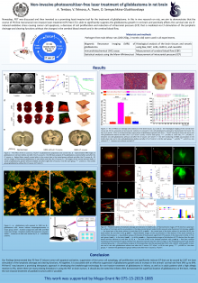 Non-invasive PS-free laser-treatment glioblastoma in rat brain
